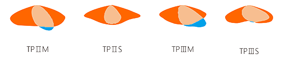 STA_curve_pic1.png